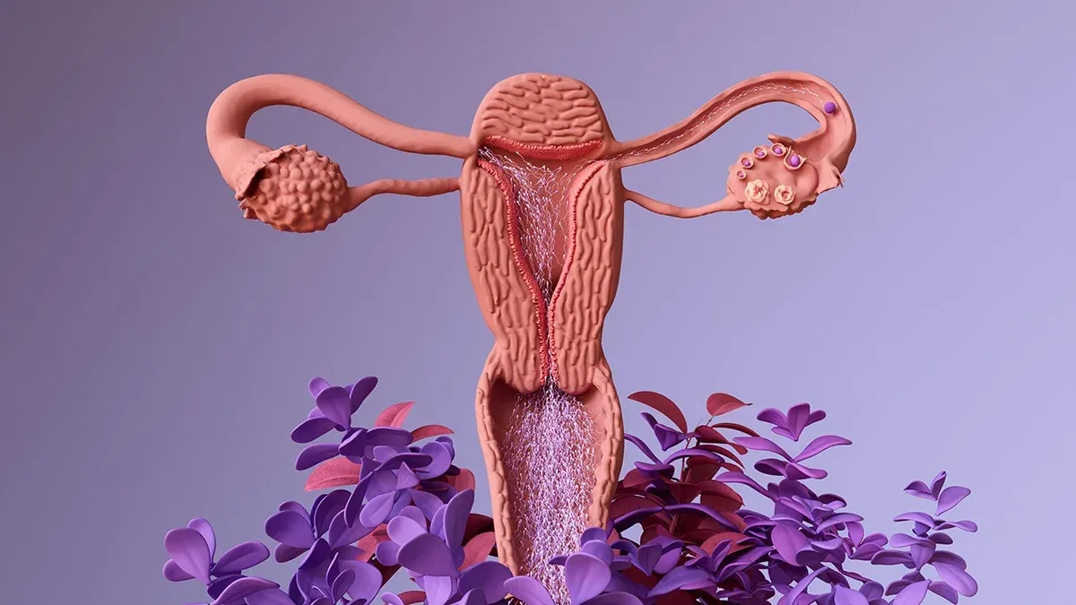 Inseminação intrauterina