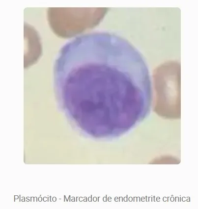 Marcadores de implantação — Plasmócitos